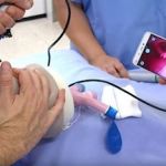 Vía aérea difícil: Videolaringoscopia