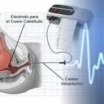 Monitorización de la frecuencia cardiaca fetal