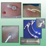 CURSO CUIDADOS DE ENFERMERÍA TERAPÉUTICA DIRIGIDA AL PACIENTE PEDIÁTRICO PORTADOR DE GASTROSTOMÍA (Ed. 1)