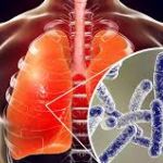 INICIAL DE MANTENIMIENTO HIGIÉNICO SANITARIO DE INSTALACIONES DE RIESGO FRENTE A LA LEGIONELLA Ed. 1