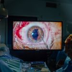 El Hospital Virgen de las Nieves incorpora tecnología 3D en un tipo de trasplante de córnea